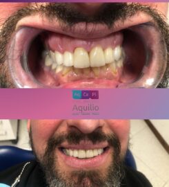 Cassarino – Aquilio – Piecoro