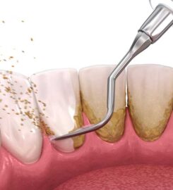 Dott. Davide Prisco Odontoiatra Manzoni Centro Odontoiatrico